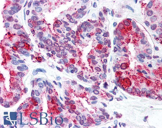 Anti-WNT5B antibody LS-A8730 IHC of human prostate. Immunohistochemistry of formalin-fixed, paraffin-embedded tissue after heat-induced antigen retrieval.