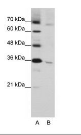 A: Marker, B: HepG2 Cell Lysate