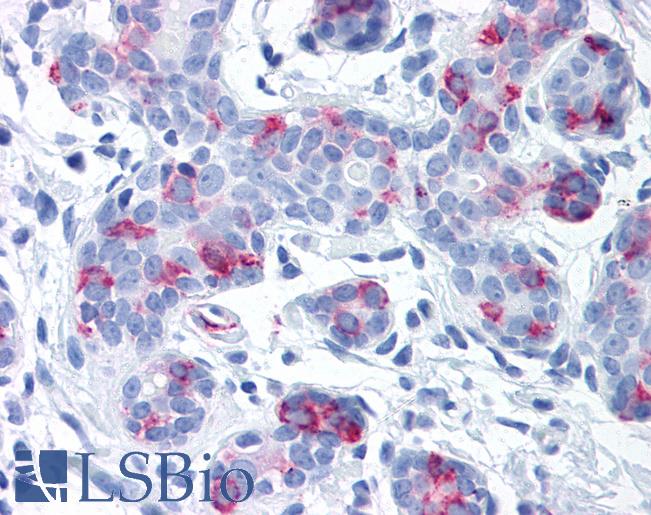Anti-WNT8A antibody LS-A8519 IHC of human breast. Immunohistochemistry of formalin-fixed, paraffin-embedded tissue after heat-induced antigen retrieval.