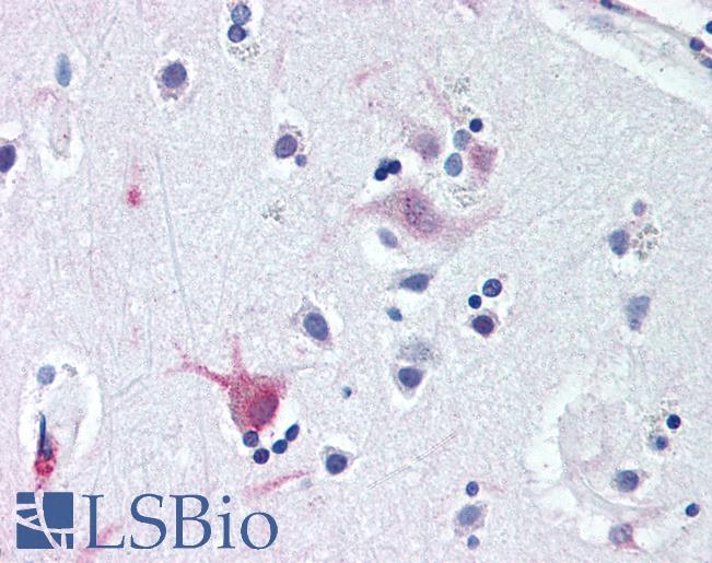 Anti-WNT8B antibody LS-A9613 IHC of human brain, cortex. Immunohistochemistry of formalin-fixed, paraffin-embedded tissue after heat-induced antigen retrieval.