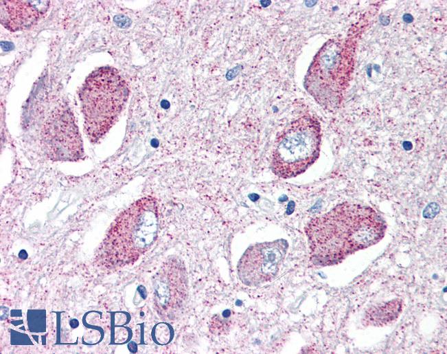 Anti-WNT8B antibody LS-A9614 IHC of human brain, basal nucleus of Meynert. Immunohistochemistry of formalin-fixed, paraffin-embedded tissue after heat-induced antigen retrieval.