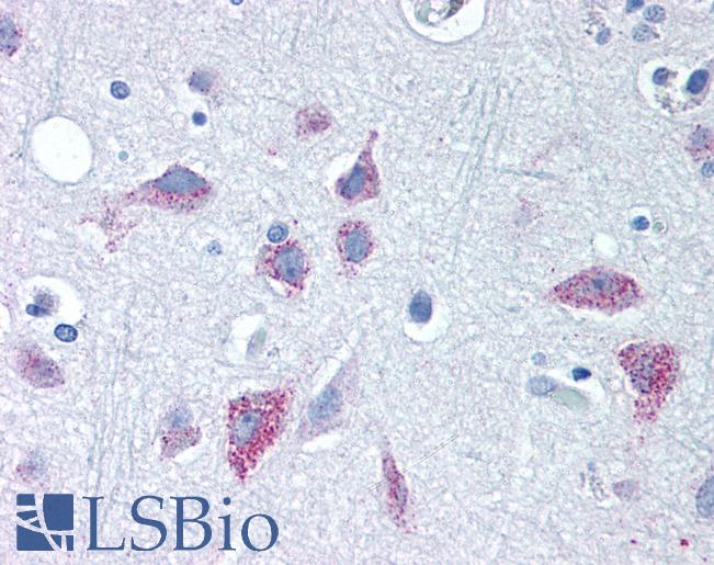 Anti-WNT8B antibody LS-A9614 IHC of human brain, cortex. Immunohistochemistry of formalin-fixed, paraffin-embedded tissue after heat-induced antigen retrieval.