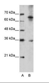 A: Marker, B: Jurkat Cell Lysate