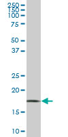 WRB monoclonal antibody (M05), clone 4D6. Western blot of WRB expression in HeLa.