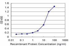 Detection limit for recombinant GST tagged WRB is approximately 1 ng/ml as a capture antibody.
