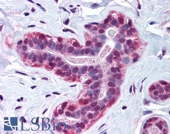 Anti-WRNIP1 / WHIP antibody IHC of human breast. Immunohistochemistry of formalin-fixed, paraffin-embedded tissue after heat-induced antigen retrieval. Antibody LS-B683 concentration 3 ug/ml.