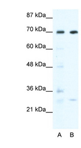 WRNIP1 / WHIP antibody LS-B683 Western blot of HepG2 cell lysate.