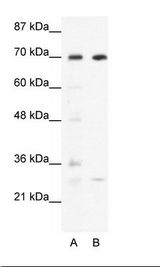 A: Marker, B: HepG2 Cell Lysate