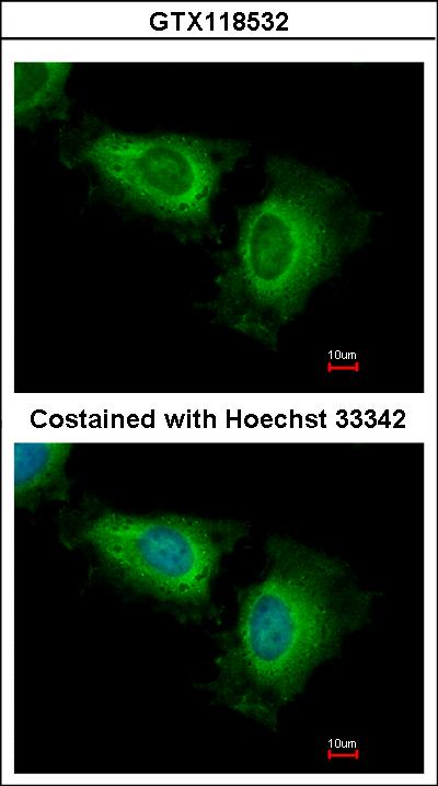 Immunofluorescence of paraformaldehyde-fixed HeLa, using WSB2 antibody at 1:500 dilution.
