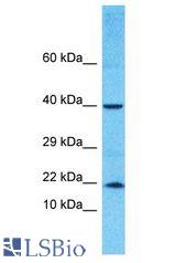 TNFAIP8L2 antibody Western Blot of MCF7. Antibody dilution: 1 ug/ml.