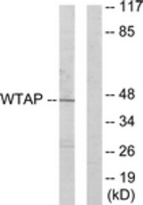 Western blot of extracts from HUVEC cells, using WTAP Antibody. The lane on the right is treated with the synthesized peptide.
