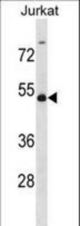 WTAP Antibody western blot of Jurkat cell line lysates (35 ug/lane). The WTAP antibody detected the WTAP protein (arrow).