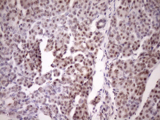 IHC of paraffin-embedded Human pancreas tissue using anti-WTAP mouse monoclonal antibody. (Heat-induced epitope retrieval by Tris-EDTA, pH8.0)(1:150).