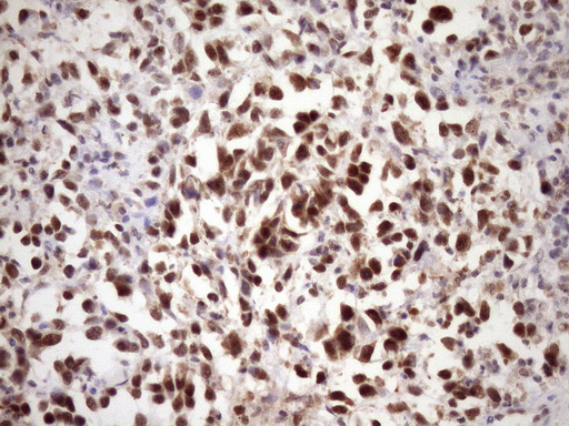 IHC of paraffin-embedded Human bladder tissue using anti-WTAP mouse monoclonal antibody. (Heat-induced epitope retrieval by Tris-EDTA, pH8.0)(1:150).