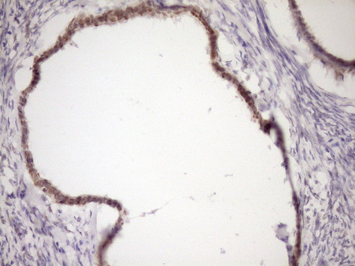 IHC of paraffin-embedded Human Ovary tissue using anti-WTAP mouse monoclonal antibody. (Heat-induced epitope retrieval by Tris-EDTA, pH8.0)(1:150).
