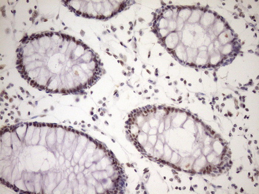 IHC of paraffin-embedded Human colon tissue using anti-WTAP mouse monoclonal antibody. (Heat-induced epitope retrieval by Tris-EDTA, pH8.0)(1:150).