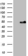 HEK293T cells were transfected with the pCMV6-ENTRY control (Left lane) or pCMV6-ENTRY WTAP (Right lane) cDNA for 48 hrs and lysed. Equivalent amounts of cell lysates (5 ug per lane) were separated by SDS-PAGE and immunoblotted with anti-WTAP (1:2000).
