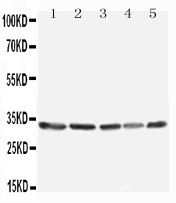 WB of TNFAIP8L3 antibody. All lanes: Anti-TNFAIP8L3 at 0.5ug/ml. Lane 1: MCF-7 Whole Cell Lysate at 40ug. Lane 2: SW620 Whole Cell Lysate at 40ug. Lane 3: COS7 Whole Cell Lysate at 40ug. Lane 4: SKOV Whole Cell Lysate at 40ug. Lane 5: JURKAT Whole Cell Lysate at 40ug. Predicted bind size: 33KD. Observed bind size: 33KD.