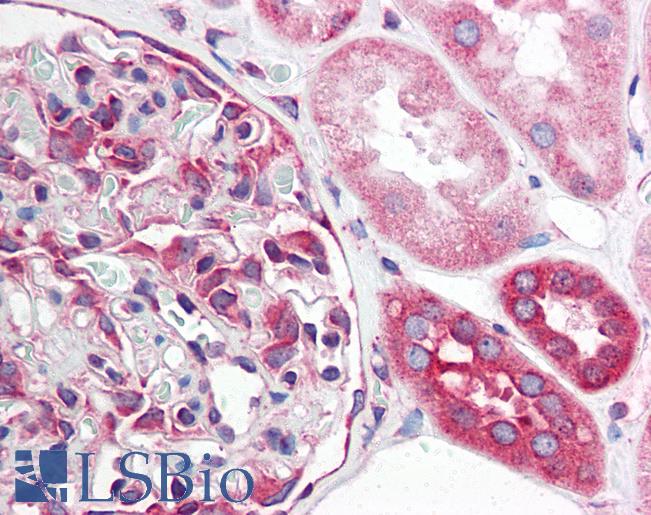 Anti-TNFRSF10A / DR4 antibody IHC of human kidney. Immunohistochemistry of formalin-fixed, paraffin-embedded tissue after heat-induced antigen retrieval. Antibody LS-B604 concentration 5 ug/ml.