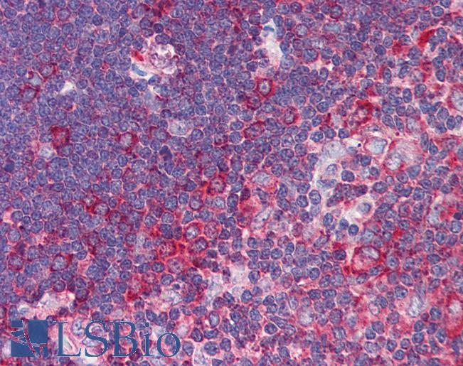 Anti-TNFRSF10A / DR4 antibody IHC of human thymus. Immunohistochemistry of formalin-fixed, paraffin-embedded tissue after heat-induced antigen retrieval. Antibody LS-B604 concentration 5 ug/ml.
