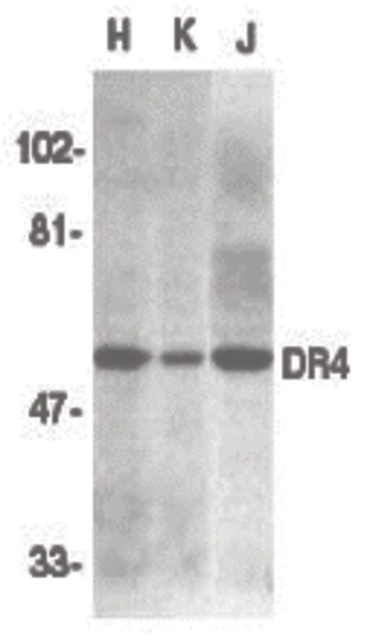 Western blot of DR4 in HeLa (H), K562 (K), and Jurkat (J) whole cell lysate with DR4 antibody at 1:500 dilution.