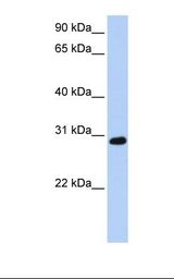 Jurkat cell lysate. Antibody concentration: 1.0 ug/ml. Gel concentration: 12%.