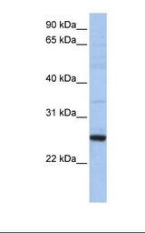721_B cell lysate. Antibody concentration: 1.0 ug/ml. Gel concentration: 12%.