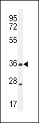 XCR1 Antibody western blot of MDA-MB435 cell line lysates (35 ug/lane). The XCR1 antibody detected the XCR1 protein (arrow).