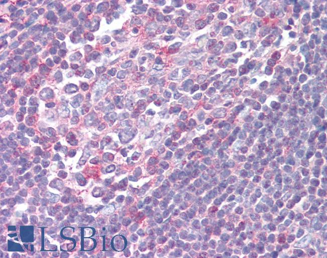 Anti-XCR1 antibody LS-A155 IHC of human tonsil. Immunohistochemistry of formalin-fixed, paraffin-embedded tissue after heat-induced antigen retrieval.