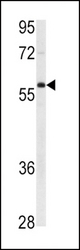 Western blot of anti-BIRC4 Antibody in Ramos cell line lysates (35 ug/lane). BIRC4(arrow) was detected using the purified antibody.