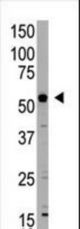 The anti-BIRC4 antibody is used in Western blot to detect BIRC4 in mouse liver tissue lysate.