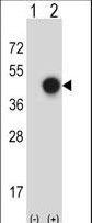 Western blot of XPA (arrow) using rabbit polyclonal XPA Antibody. 293 cell lysates (2 ug/lane) either nontransfected (Lane 1) or transiently transfected (Lane 2) with the XPA gene.