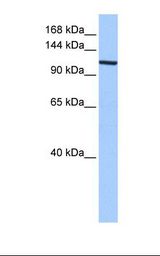 Fetal heart cell lysate. Antibody concentration: 0.5 ug/ml. Gel concentration: 6%-18%.