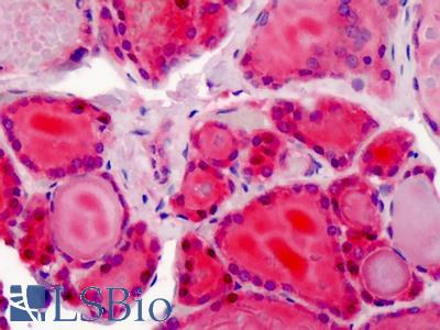 Anti-CRM1 antibody IHC of human thyroid. Immunohistochemistry of formalin-fixed, paraffin-embedded tissue after heat-induced antigen retrieval. Antibody LS-B1776 concentration 10 ug/ml.