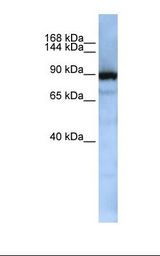 Jurkat cell lysate. Antibody concentration: 1.0 ug/ml. Gel concentration: 6-18%.