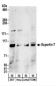 Detection of Human and Mouse Exportin-T by Western Blot. Samples: Whole cell lysate (50 ug) from 293T, HeLa, Jurkat, and mouse TCMK-1 cells. Antibodies: Affinity purified rabbit anti-Exportin-T antibody used for WB at 0.4 ug/ml. Detection: Chemiluminescence with an exposure time of 3 minutes.