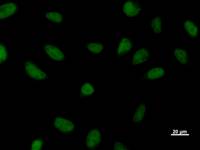 Immunostaining analysis in HeLa cells. HeLa cells were fixed with 4% paraformaldehyde and permeabilized with 0.1% Triton X-100 in PBS. The cells were immunostained with anti-XPOT mAb.