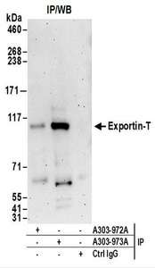 Detection of Human Exportin-T by Western Blot of Immunoprecipitates. Samples: Whole cell lysate (1 mg for IP; 20% of IP loaded) from 293T cells. Antibodies: Affinity purified rabbit anti-Exportin-T antibody used for IP at 6 ug/mg lysate. Exportin-T was inefficiently immunoprecipitated by rabbit anti-Exportin-T antibody A303-972.A. For blotting immunoprecipitated Exportin-T, was used at 1 ug/ml. Detection: Chemiluminescence with an exposure time of 3 minutes.