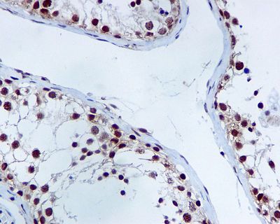 IHC of paraffin-embedded human testis tissue using anti-XRCC1 antibody.