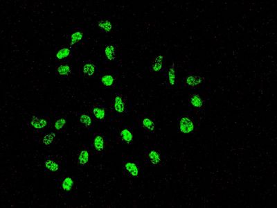 Immunofluorescent staining of HeLa cells using anti-XRCC1 antibody.