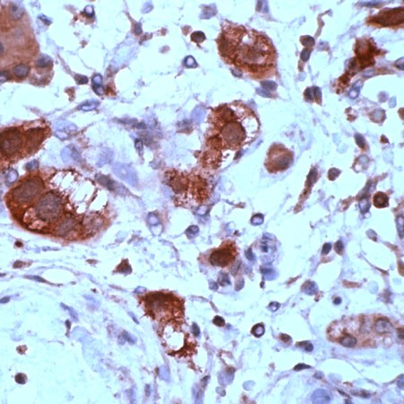 Human testis stained with Anti-XRCC2 antibody