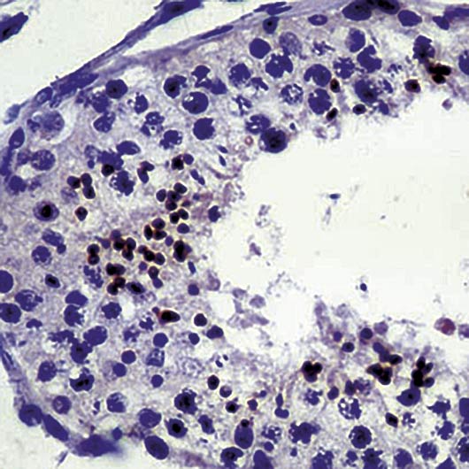 Formalin-fixed, paraffin-embedded human testis stained with XRCC2 antibody LS-C95916.