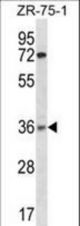 XRCC2 Antibody western blot of ZR-75-1 cell line lysates (35 ug/lane). The XRCC2 antibody detected the XRCC2 protein (arrow).