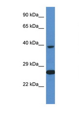 XRCC3 antibody LS-C145306 Western blot of ACHN Cell lysate. Antibody concentration 1 ug/ml.
