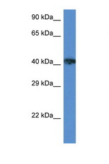 XRCC3 antibody LS-C145307 Western blot of ACHN Cell lysate. Antibody concentration 1 ug/ml.