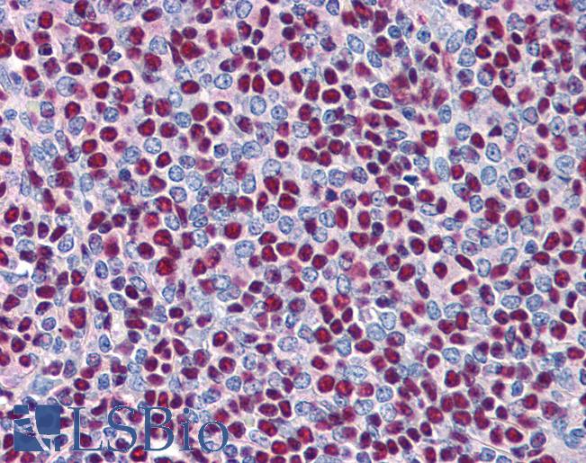 Anti-XRCC5 / Ku80 antibody IHC of human spleen. Immunohistochemistry of formalin-fixed, paraffin-embedded tissue after heat-induced antigen retrieval. Antibody LS-B2584 concentration 5 ug/ml.