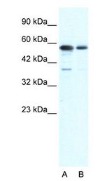 XRCC6 / Ku70 antibody Western Blot of HepG2 cell lysate. XRCC6 is supported by BioGPS gene expression data to be expressed in HepG2.