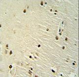 XRCC6 antibody immunohistochemistry of formalin-fixed and paraffin-embedded human brain tissue followed by peroxidase-conjugated secondary antibody and DAB staining.