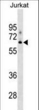 XYLB Antibody western blot of Jurkat cell line lysates (35 ug/lane). The XYLB antibody detected the XYLB protein (arrow).