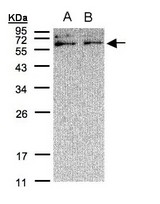 Sample (30 ug of whole cell lysate). A: A431, B: H1299. 12% SDS PAGE. XYLB antibody diluted at 1:500